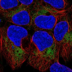 TOMM40 Antibody, Novus Biologicals 0.1mL; Unlabeled:Antibodies, Polyclonal